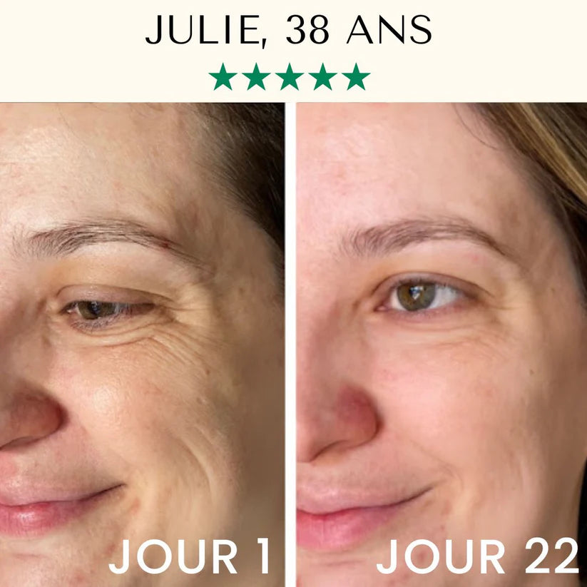 LightPro 7en1 ™ Lifting Luminothérapie